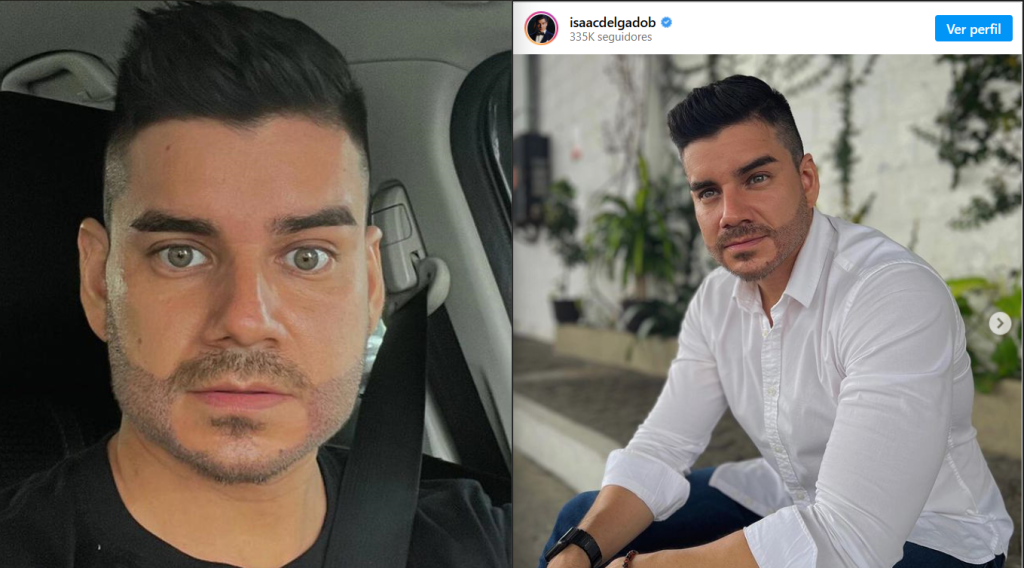 Isaac Delgado se implantó barba y los hate no se dejaron esperar